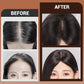 🔥LAST DAY 50% OFF🔥Hybrid Hairline Topper